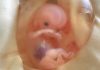 Ohio Senate Passes Bill to Ban All Abortions After an Unborn Baby’s Heartbeat Begins