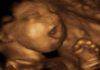 Ohio Bill Bans All Abortions, Declares Unborn Babies as People Under Law