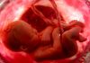 Abortion Leading Cause of Death in 2018 with 41 Million Killed